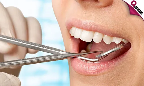 Dental Scaling & Polishing!